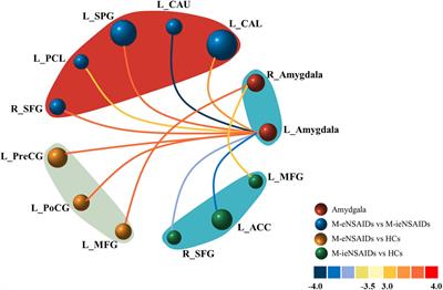 Disrupted Functional Connectivity of the Amygdala Predicts the Efficacy of Non-steroidal Anti-inflammatory Drugs in Migraineurs Without Aura